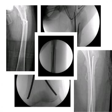 Slider image (4) Dr. Rodrigo Aguirre Rojas Orthopedic Surgeon in Mexico